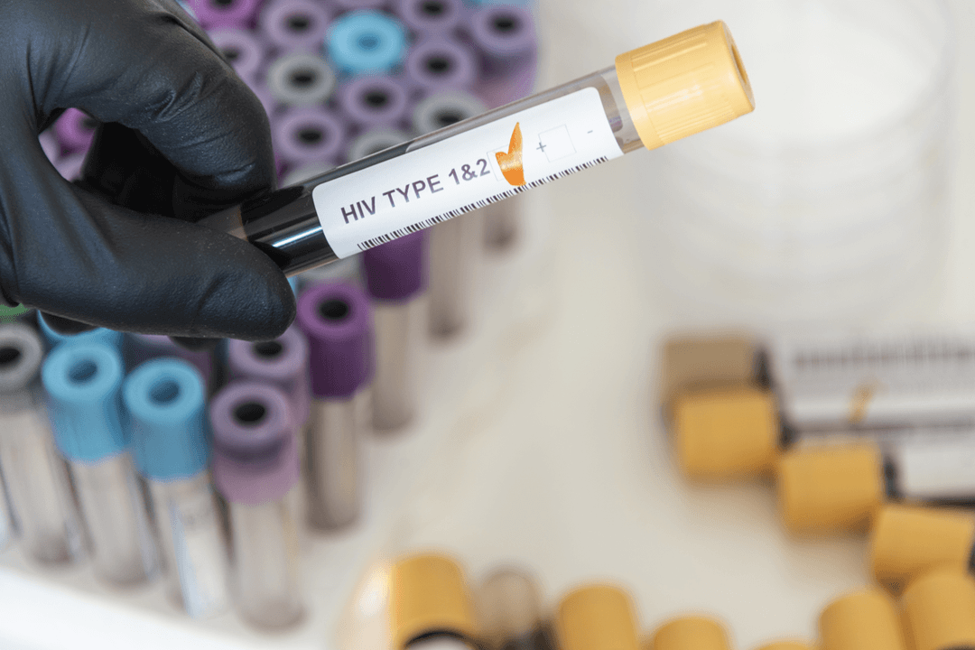 <strong>A Comprehensive Guide to HIV: Everything You Need to Know</strong>