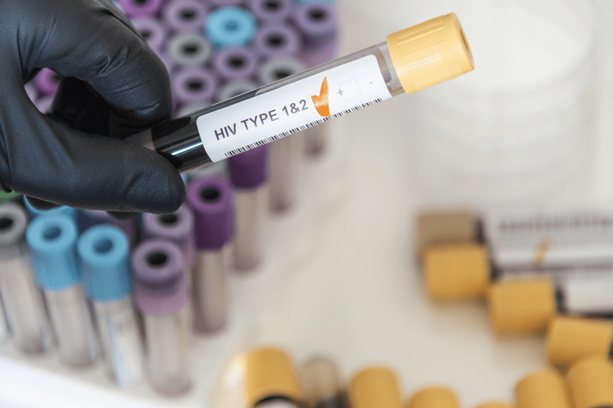 <strong>A Comprehensive Guide to HIV: Everything You Need to Know</strong>