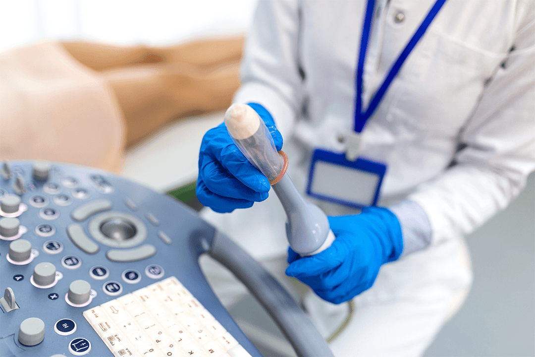 <strong>Pap Smear Test: A Simple Screening that Makes a Big Difference</strong>