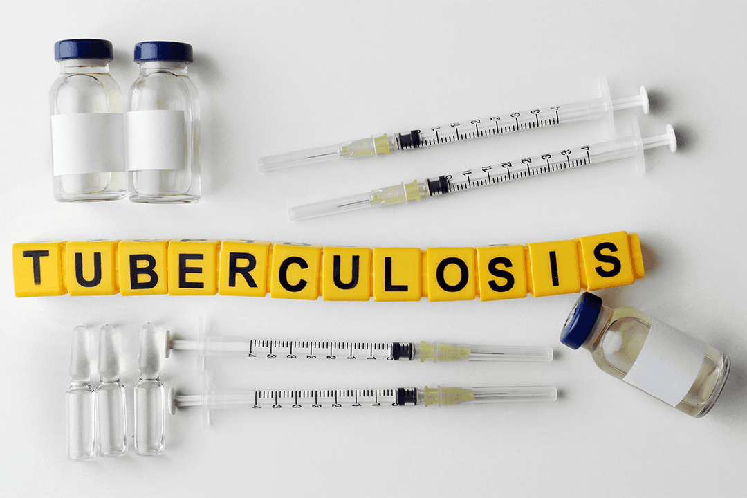 Tuberculosis: What You Need to Know About Its Causes, Symptoms, and Treatment
