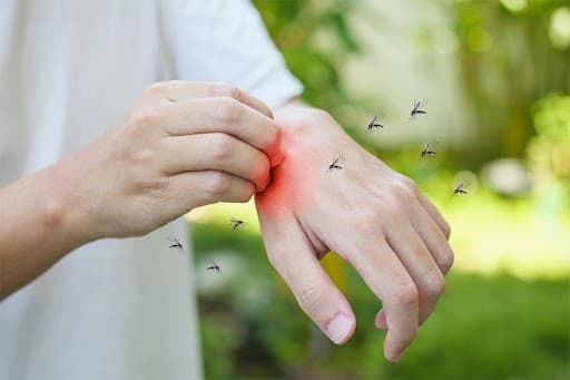 Dengue: Symptoms, Treatment & Prevention