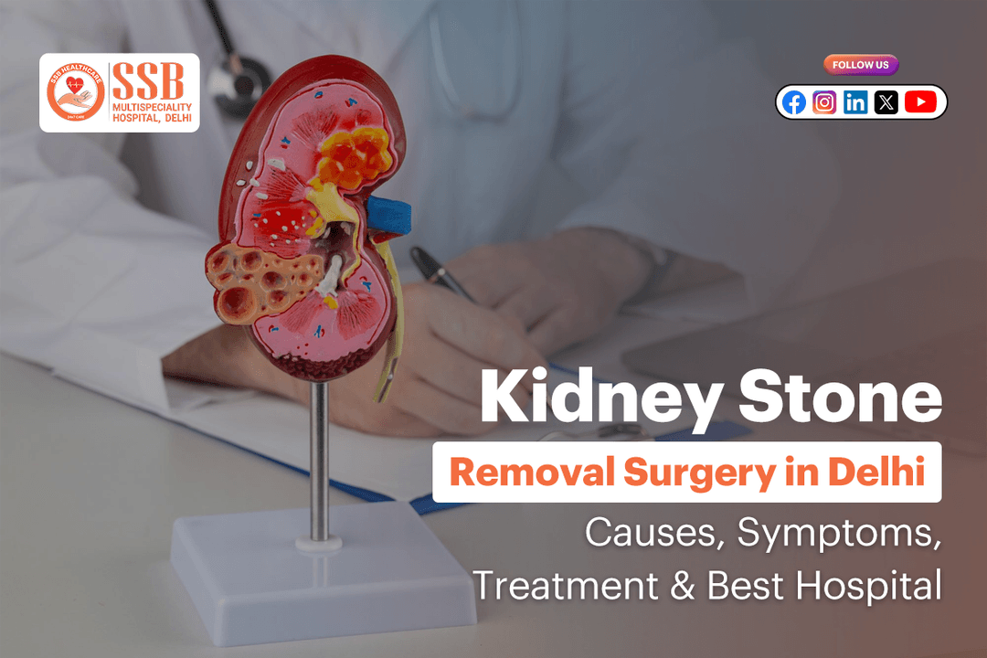 Kidney Stone Removal Surgery in Delhi: Causes, Symptoms, Treatment &amp; Best Hospital