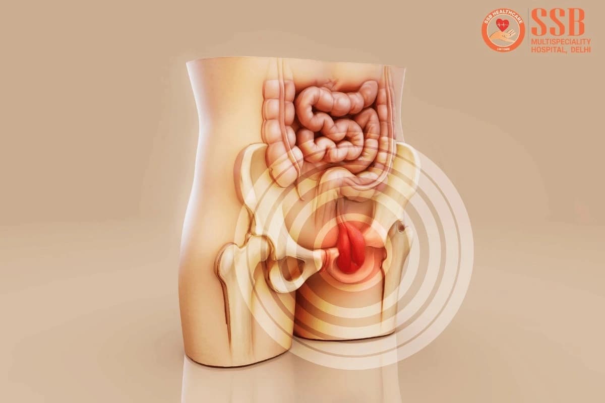 Hernia surgery in Delhi: when watchful waiting is no longer enough