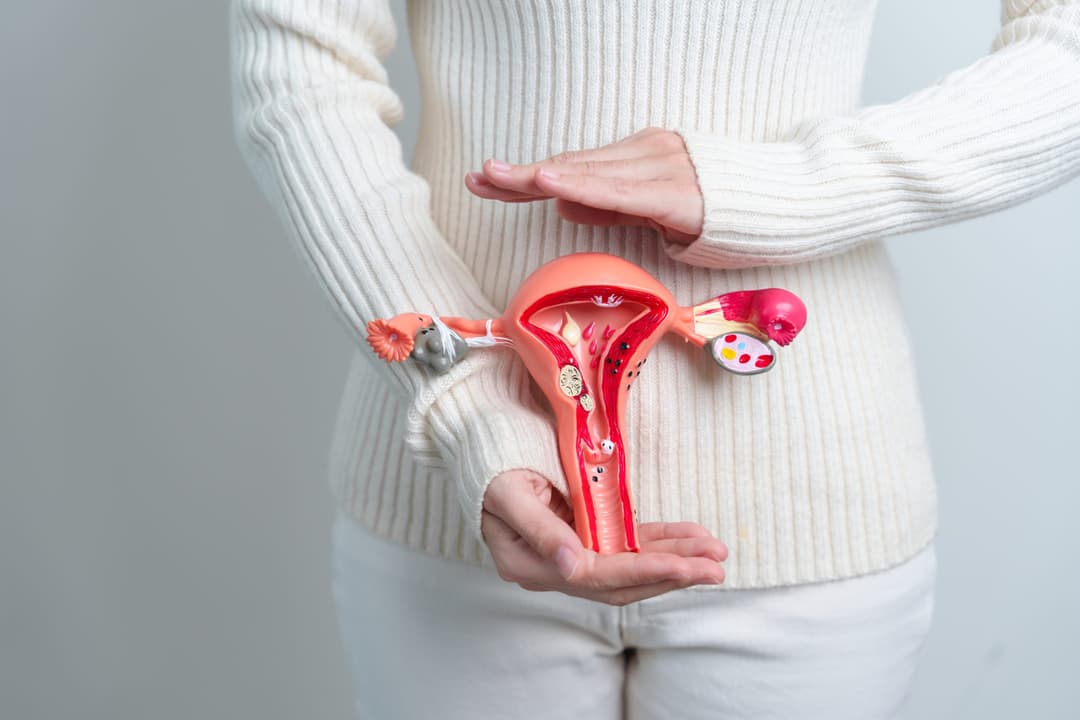 PCOD or PCOS: Causes, Symptoms & Treatment